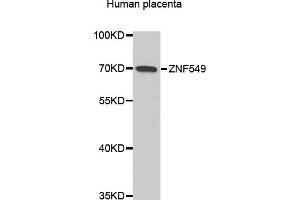 Western blot analysis of extracts of Human placenta, using ZNF549 antibody (ABIN6293799) at 1:1000 dilution. (ZNF549 antibody)