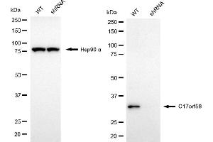 anti-Chromosome 17 Open Reading Frame 58 (C17ORF58) antibody