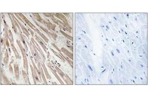 Immunohistochemistry analysis of paraffin-embedded human heart tissue, using ARPP21 Antibody. (ARPP21 antibody  (AA 211-260))