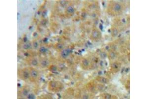 IHC-P analysis of Liver tissue, with DAB staining. (OLR1 antibody  (AA 60-312))