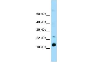 Western Blotting (WB) image for anti-Regenerating Islet-Derived 1 (REG1) (Middle Region) antibody (ABIN2789530) (REG1 antibody  (Middle Region))