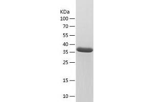 Western Blotting (WB) image for Ectonucleoside Triphosphate diphosphohydrolase 1 (ENTPD1) (AA 70-197) protein (His-IF2DI Tag) (ABIN7282611) (CD39 Protein (AA 70-197) (His-IF2DI Tag))