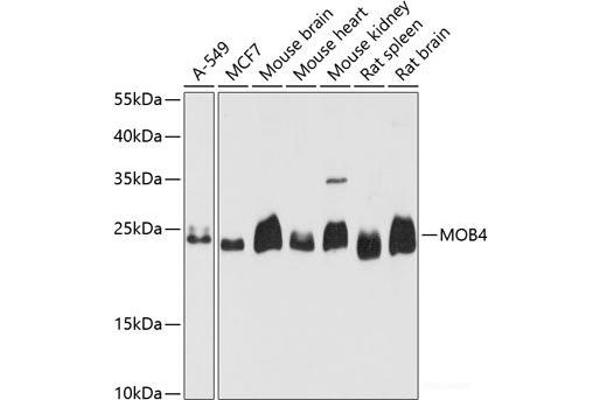 MOBKL3 antibody
