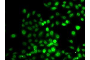 Immunofluorescence analysis of A549 cell using PRDM7 antibody. (PRDM7 antibody)