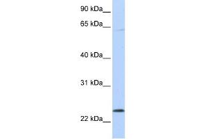 WB Suggested Anti-CHAC1 Antibody Titration: 0. (CHAC1 antibody  (C-Term))