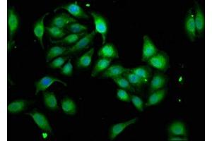 Immunofluorescence staining of A549 cells with ABIN7175838 at 1:33, counter-stained with DAPI. (WASF3 antibody  (AA 368-502))