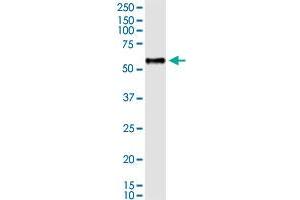 Immunoprecipitation of BCL3 transfected lysate using rabbit polyclonal anti-BCL3 and Protein A Magnetic Bead (BCL3 (Human) IP-WB Antibody Pair)