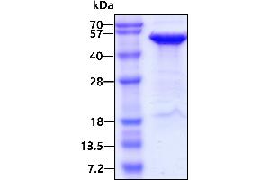 Reticulocalbin 1, EF-Hand Calcium Binding Domain (RCN1) (AA 30-331) protein (His tag)