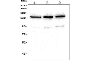 Western blot analysis of PHLPP1 using anti-PHLPP1 antibody (ABIN7599695).