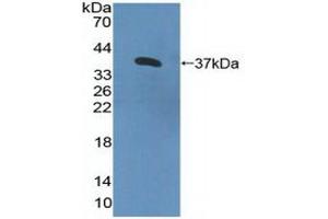 Detection of Recombinant IL8Rb, Human using Polyclonal Antibody to Interleukin 8 Receptor Beta (IL8Rb) (CXCR2 antibody  (AA 1-57))