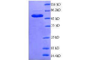 SDS-PAGE (SDS) image for Endoplasmic Reticulum Protein 29 (ERP29) (AA 40-251), (partial) protein (GST tag) (ABIN4976527) (ERP29 Protein (AA 40-251, partial) (GST tag))