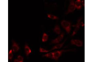 ABIN6274834 staining 293 by IF/ICC. (AASS antibody  (C-Term))