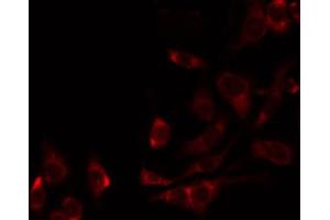 ABIN6274834 staining 293 by IF/ICC. (AASS antibody  (C-Term))