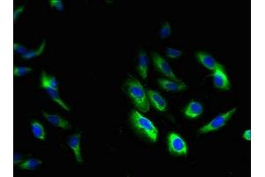 Immunofluorescent analysis of Hela cells using ABIN7154840 at dilution of 1:100 and Alexa Fluor 488-congugated AffiniPure Goat Anti-Rabbit IgG(H+L) (HAX1 antibody  (AA 2-250))