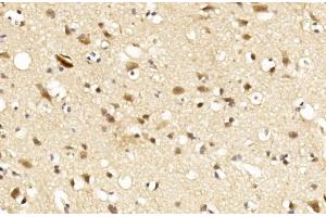 Immunohistochemical analysis of paraffin-embedded Human brain section using LINGO-1(LRRN6A)- (C-term) Antibody (ABIN651289 and ABIN2840172). (LINGO1 antibody  (C-Term))