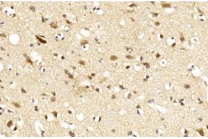 Immunohistochemical analysis of paraffin-embedded Human brain section using LINGO-1(LRRN6A)- (C-term) Antibody (ABIN651289 and ABIN2840172). (LINGO1 antibody  (C-Term))