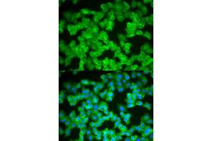 Immunofluorescence (IF) image for anti-S100 Calcium Binding Protein A12 (S100A12) antibody (ABIN1876516) (S100A12 antibody)