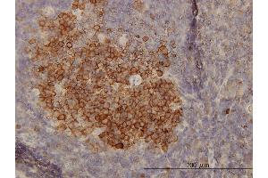 Immunostaining (ISt) image for anti-phosphoglycerate Dehydrogenase (PHGDH) (AA 1-533) antibody (ABIN565240)