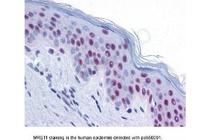 Image no. 2 for anti-MRE11 Meiotic Recombination 11 Homolog A (S. Cerevisiae) (MRE11A) antibody (ABIN363310)