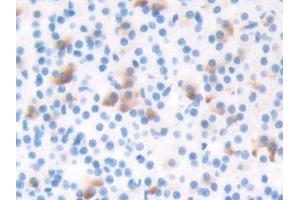 DAB staining on IHC-P; Samples: Rat Adrenal gland Tissue (TBX3 antibody  (AA 107-220))
