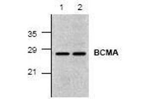 Image no. 1 for anti-Tumor Necrosis Factor Receptor Superfamily, Member 17 (TNFRSF17) (C-Term) antibody (ABIN127204) (BCMA antibody  (C-Term))