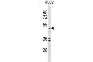 Western Blotting (WB) image for anti-Uronyl-2-Sulfotransferase (UST) antibody (ABIN2999336) (UST antibody)