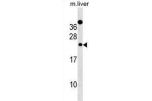 Western Blotting (WB) image for anti-Der1-Like Domain Family, Member 2 (DERL2) antibody (ABIN3000861) (Der1-Like Domain Family, Member 2 (DERL2) antibody)
