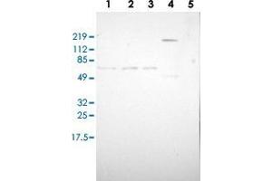 Western blot analysis of Lane 1: RT-4, Lane 2: U-251 MG, Lane 3: A-431, Lane 4: Liver, Lane 5: Tonsil with ZBTB16 polyclonal antibody  at 1:100-1:250 dilution. (ZBTB16 antibody)