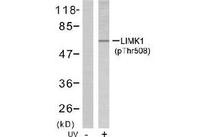 Image no. 2 for anti-LIM Domain Kinase 1 (LIMK1) (pThr508) antibody (ABIN196831) (LIM Domain Kinase 1 antibody  (pThr508))