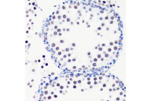 Immunohistochemistry of paraffin-embedded mouse testis using MonoMethyl-Histone H3-R8 antibody (ABIN3017482, ABIN3017483, ABIN3017484 and ABIN6220107) at dilution of 1:100 (40x lens). (Histone 3 antibody  (H3R8me))