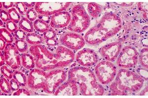 Human Kidney: Formalin-Fixed, Paraffin-Embedded (FFPE) (APOA2 antibody)
