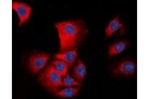 Immunofluorescent analysis of ASC staining in HepG2 cells. (STS antibody  (N-Term))