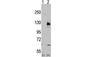 Western blot analysis of TRPM8 antibody and 293 cell lysate either nontransfected (Lane 1) or transiently transfected with the TRPM8 gene (2). (TRPM8 antibody  (AA 926-956))