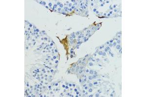 Immunohistochemistry of paraffin-embedded mouse testis using KLKB1 antibody (ABIN6129406, ABIN6142965, ABIN6142967 and ABIN6217272) at dilution of 1:200 (40x lens).