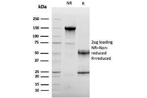 SDS-PAGE Analysis Purified Endoglin / CD105 Mouse Monoclonal Antibody (ENG/3269). (Endoglin antibody  (AA 74-251))