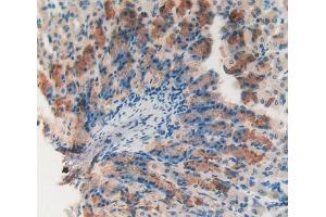 IHC-P analysis of Mouse Stomach Tissue, with DAB staining. (Catalase antibody  (AA 32-157))