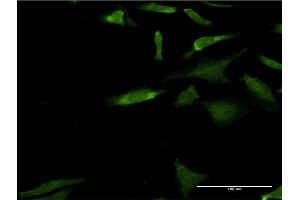 Immunofluorescence of monoclonal antibody to MAPK3 on HeLa cell. (ERK1 antibody  (AA 279-379))