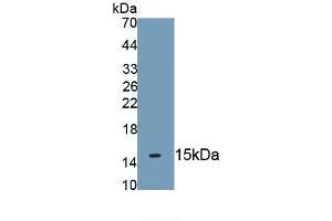 Detection of Recombinant KRT2, Human using Monoclonal Antibody to Keratin 2 (CK2) (Keratin 2 antibody  (AA 7-160))