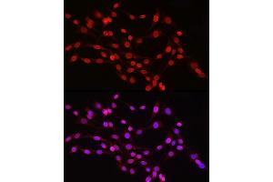 Immunofluorescence analysis of PC-12 cells using Lamin B1 Rabbit pAb (ABIN3015697, ABIN3015698, ABIN3015699, ABIN1680700 and ABIN6219049) at dilution of 1:150 (40x lens). (Lamin B1 antibody  (AA 397-586))