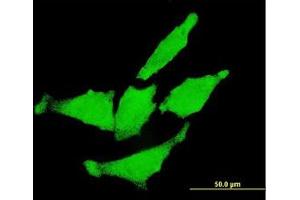 Image no. 1 for anti-Receptor tyrosine-protein kinase erbB-2 (ErbB2/Her2) (AA 22-122) antibody (ABIN599374) (ErbB2/Her2 antibody  (AA 22-122))
