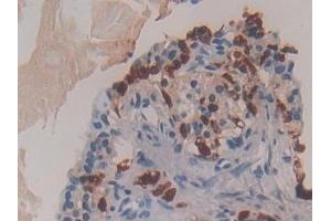 Immunohistochemistry (IHC) image for anti-Multiple Endocrine Neoplasia 1 (MEN1) (AA 219-395) antibody (ABIN7443704)