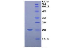 SDS-PAGE (SDS) image for Cyclophilin B (PPIB) ELISA Kit (ABIN6730860)