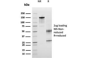SDS-PAGE Analysis Purified ICOS-L Mouse Monoclonal Antibody (ICOSL/3260). (ICOSLG antibody  (AA 23-149))