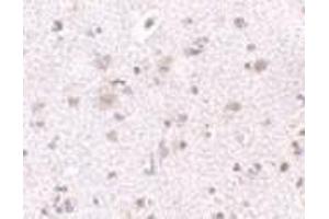 Immunohistochemistry of BRCC45 in human brain tissue with BRCC45 antibody at 2. (BRE antibody  (N-Term))