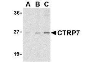 Western blot analysis of CTRP7 in 3T3 cell lysate with AP30259PU-N CTRP7 antibody at (A) 1, (B) 2, and (C) 4 μg/ml. (CTRP7 antibody  (N-Term))