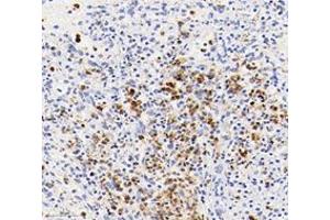 Immunohistochemistry analysis of paraffin-embedded human spleen using,S100A12 (ABIN7075493) at dilution of 1: 4000 (S100A12 antibody)