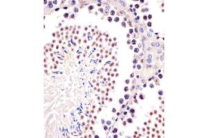 (ABIN6244019 and ABIN6577664) staining (Mouse) Trim24 in mouse testis sections by Immunohistochemistry (IHC-P - paraformaldehyde-fixed, paraffin-embedded sections). (TRIM24 antibody  (C-Term))
