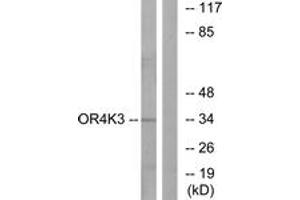 Western blot analysis of extracts from Jurkat cells, using OR4K3 Antibody. (OR4K3 antibody  (AA 266-315))