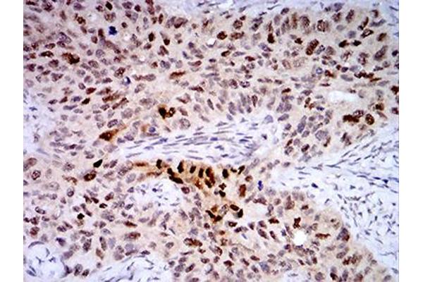 TTF1 antibody  (AA 1-150)