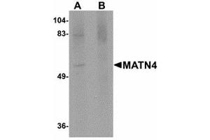 Image no. 1 for anti-Matrilin 4 (MATN4) (N-Term) antibody (ABIN478066) (MATN4 antibody  (N-Term))